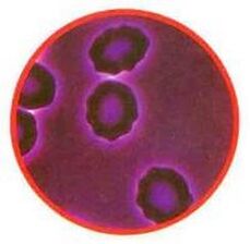 Red blood cell stress