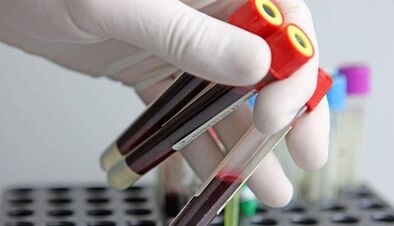 How to take parasitic tests in the body