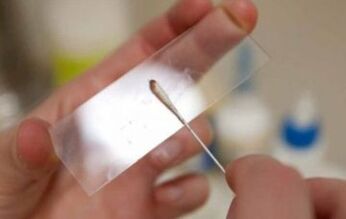 What tests to take for parasites