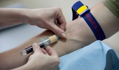 how to prepare a parasitic test