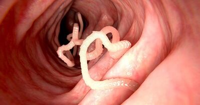 Causes of parasites in the human body